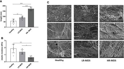 Bone marrow mesenchymal stromal cell-derived extracellular matrix displays altered glycosaminoglycan structure and impaired functionality in Myelodysplastic Syndromes